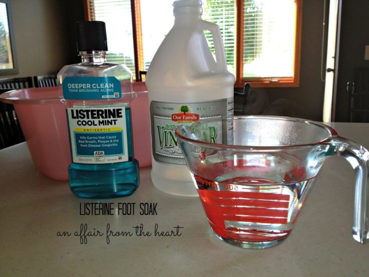 Listerine Foot Soak \u0026 Callus Remover