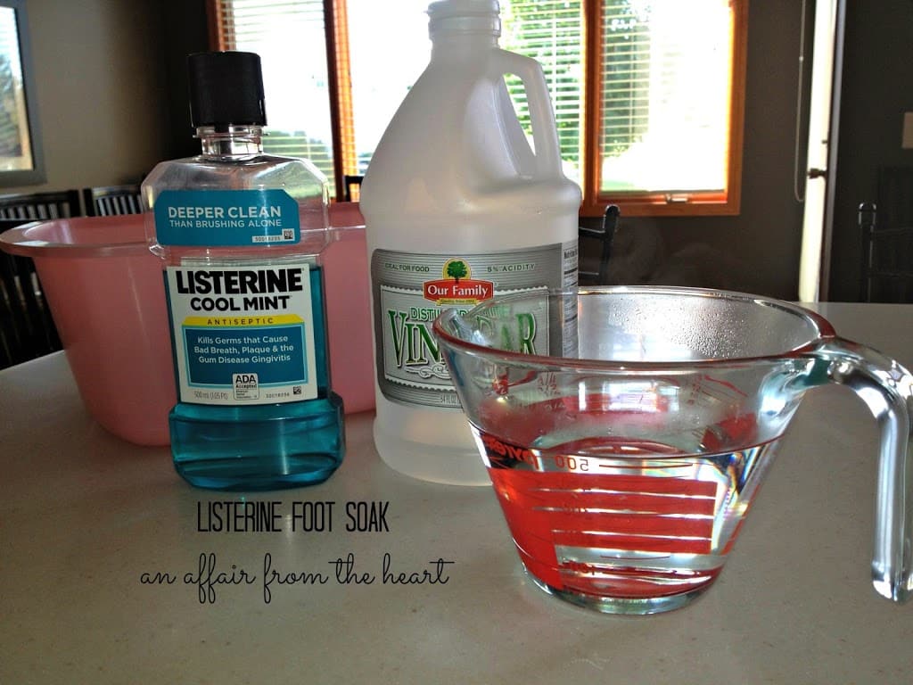 Listerine Foot Soak & Callus Remover